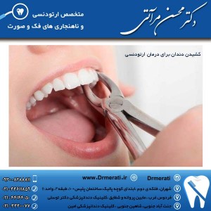 کشیدن دندان برای درمان ارتودنسی: