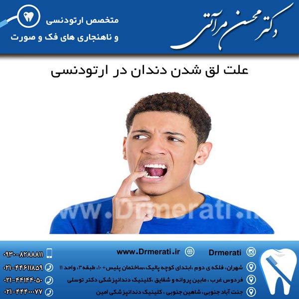 علت لق شدن دندان در ارتودنسی