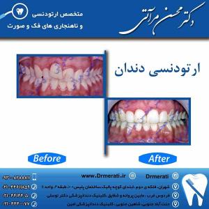 دکتر محسن مرآتی - متخصص ارتودنسی 