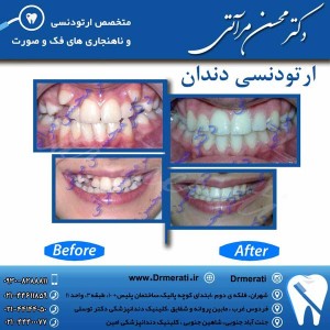 دکتر محسن مرآتی - متخصص ارتودنسی 