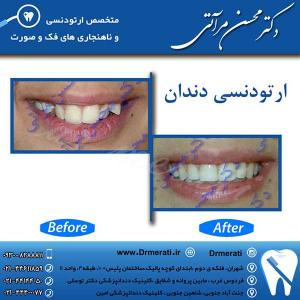 دکتر محسن مرآتی - متخصص ارتودنسی 