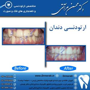 دکتر محسن مرآتی - متخصص ارتودنسی 