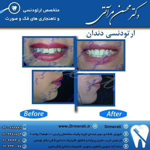 دکتر محسن مرآتی - متخصص ارتودنسی 