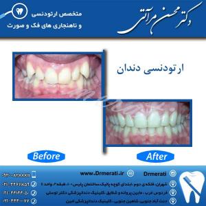 دکتر محسن مرآتی - متخصص ارتودنسی 