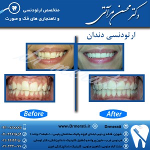 دکتر محسن مرآتی - متخصص ارتودنسی 