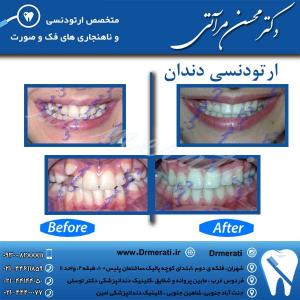 دکتر محسن مرآتی - متخصص ارتودنسی 