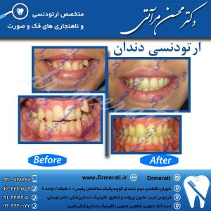 دکتر محسن مرآتی - متخصص ارتودنسی 