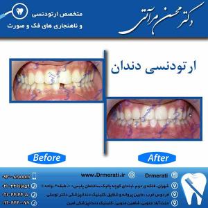 دکتر محسن مرآتی - متخصص ارتودنسی 